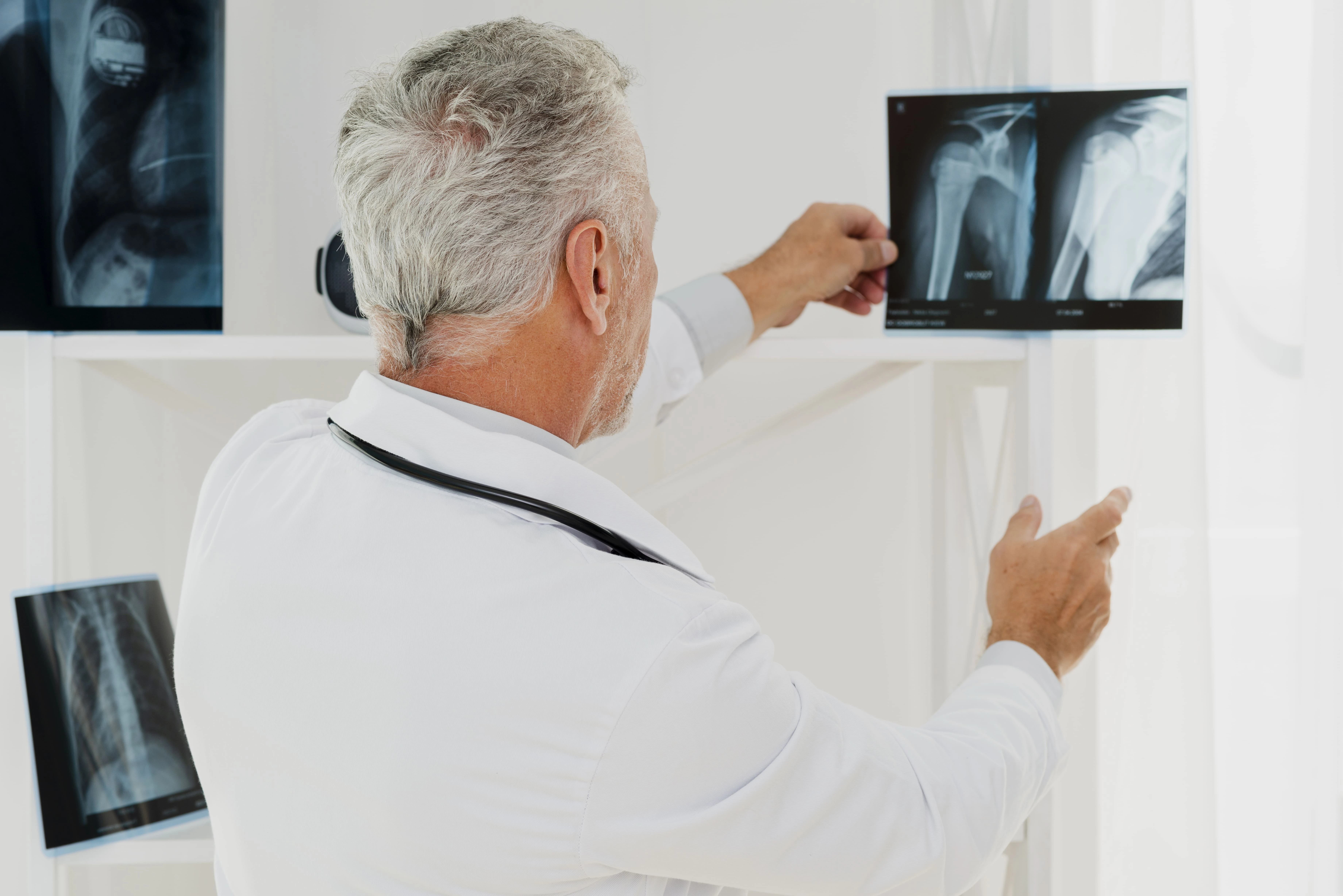 Radiografia ginocchio